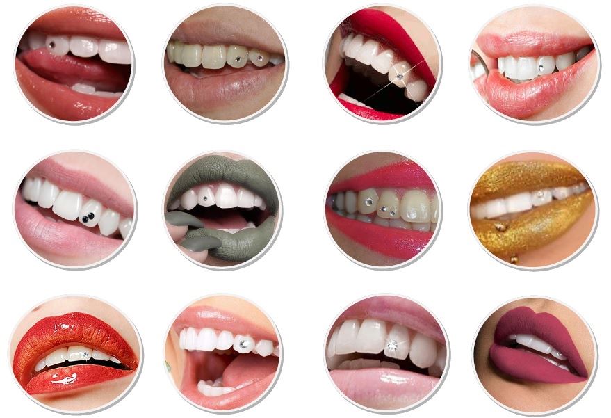 Kit Joyas Dentales - Imagen 2